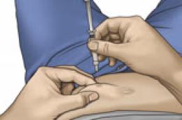How to Give a Subcutaneous Injection